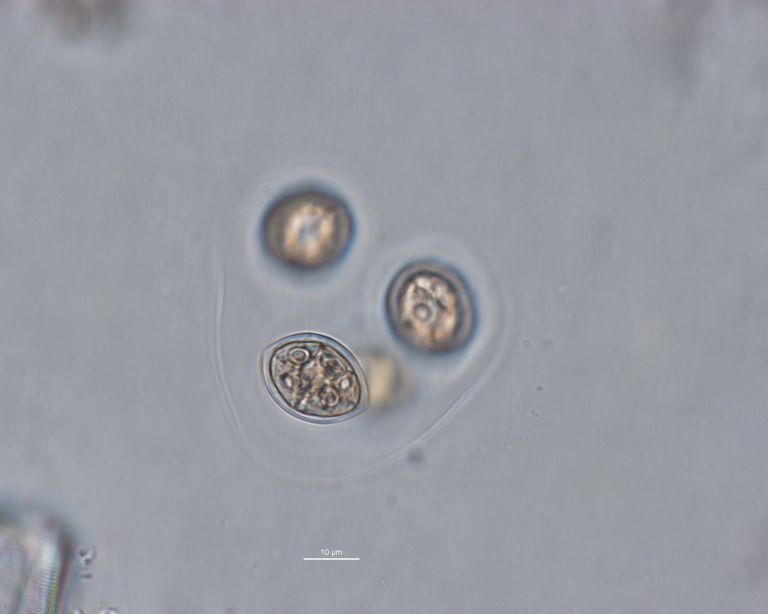 Dictyocha speculum